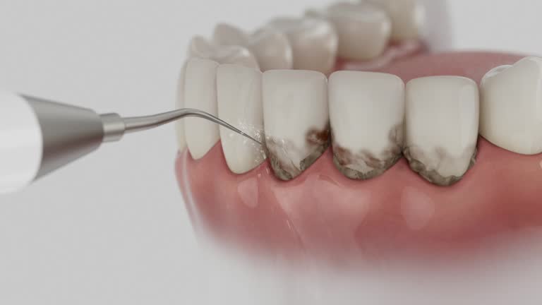 Reliable Dental contractor in Metuchen, NJ by Dentist Open Now